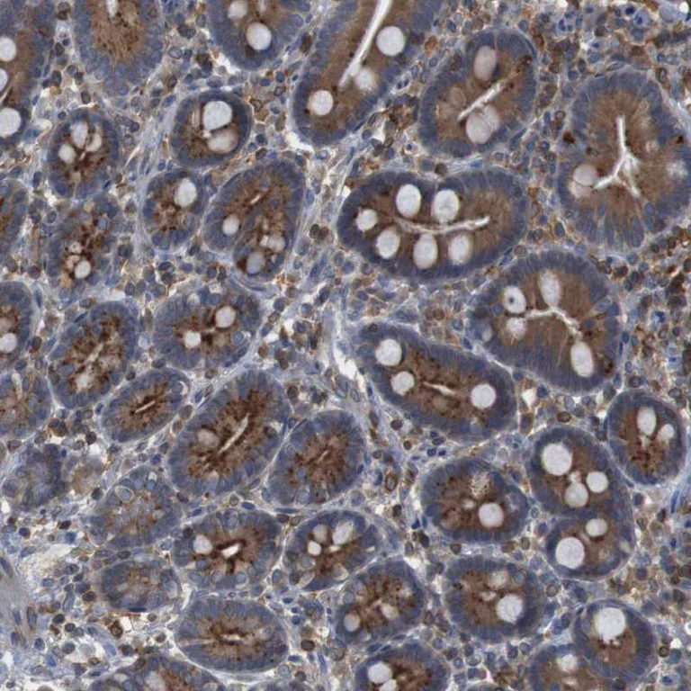 Immunohistochemistry (Formalin/PFA-fixed paraffin-embedded sections) - Anti-JWA antibody (AB252960)