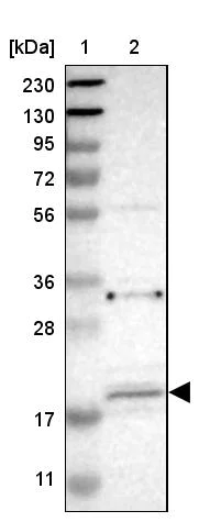 Western blot - Anti-JWA antibody (AB252960)