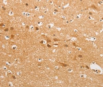 Immunohistochemistry (Formalin/PFA-fixed paraffin-embedded sections) - Anti-K Cadherin/CDH6 antibody (AB197845)