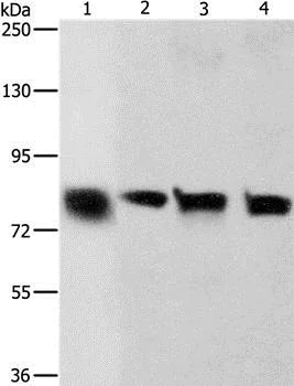 Western blot - Anti-K Cadherin/CDH6 antibody (AB197845)