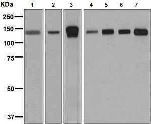 Western blot - Anti-K Cadherin/CDH6 antibody [EPR7394] - BSA and Azide free (AB248582)