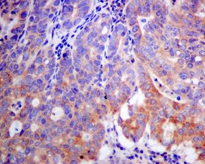 Immunohistochemistry (Formalin/PFA-fixed paraffin-embedded sections) - Anti-K23 antibody [EPR10943] - BSA and Azide free (AB249264), expandable thumbnail