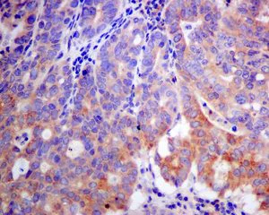 Immunohistochemistry (Formalin/PFA-fixed paraffin-embedded sections) - Anti-K23 antibody [EPR10943] - BSA and Azide free (AB249264)
