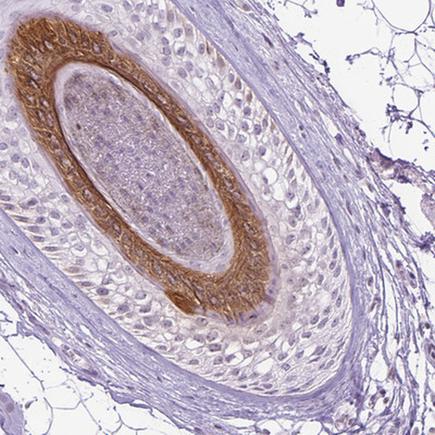 Immunohistochemistry (Formalin/PFA-fixed paraffin-embedded sections) - Anti-K27 antibody (AB220725), expandable thumbnail