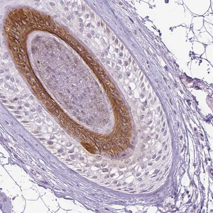 Immunohistochemistry (Formalin/PFA-fixed paraffin-embedded sections) - Anti-K27 antibody (AB220725)