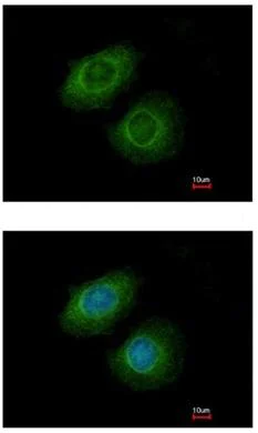 Immunocytochemistry/ Immunofluorescence - Anti-K31 antibody (AB111730)