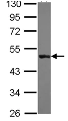Western blot - Anti-K31 antibody (AB111730)