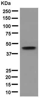 Western blot - Anti-K31 antibody [EPR12849] - BSA and Azide free (AB250331)