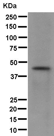 Western blot - Anti-K31 antibody [EPR12849] - N-terminal (AB181081)