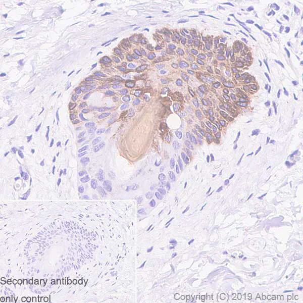 Immunohistochemistry (Formalin/PFA-fixed paraffin-embedded sections) - Anti-K31 antibody [EPR12855(B)] - BSA and Azide free (AB250025)