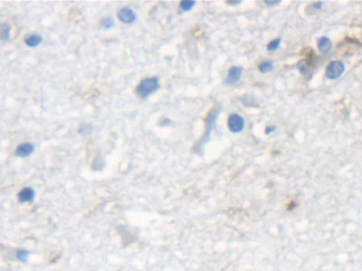 Immunohistochemistry (Formalin/PFA-fixed paraffin-embedded sections) - Anti-K33A antibody (AB233139)