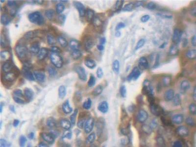 Immunohistochemistry (Formalin/PFA-fixed paraffin-embedded sections) - Anti-K33A antibody (AB233139)