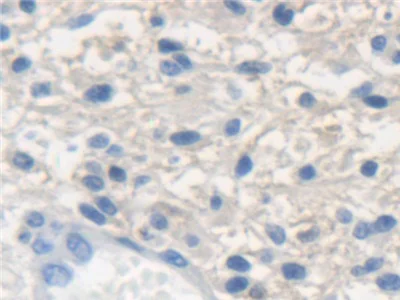 Immunohistochemistry (Formalin/PFA-fixed paraffin-embedded sections) - Anti-K33A antibody (AB233139)