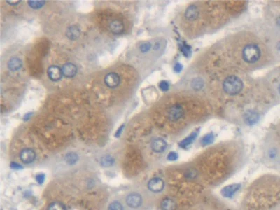 Immunohistochemistry (Formalin/PFA-fixed paraffin-embedded sections) - Anti-K33A antibody (AB233139)