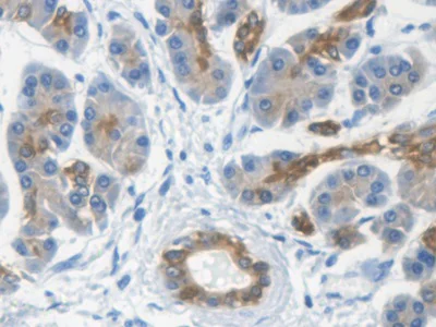 Immunohistochemistry (Formalin/PFA-fixed paraffin-embedded sections) - Anti-K33A antibody (AB233139)