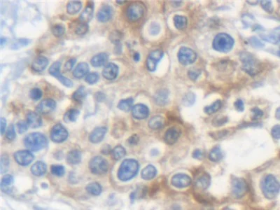 Immunohistochemistry (Formalin/PFA-fixed paraffin-embedded sections) - Anti-K33A antibody (AB233139)