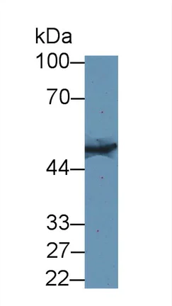 Western blot - Anti-K33A antibody (AB233139)