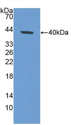 Western blot - Anti-K33A antibody (AB233139)