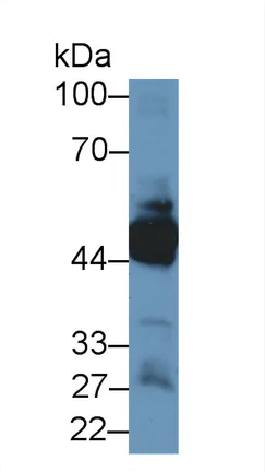 Western blot - Anti-K33A antibody (AB233139)