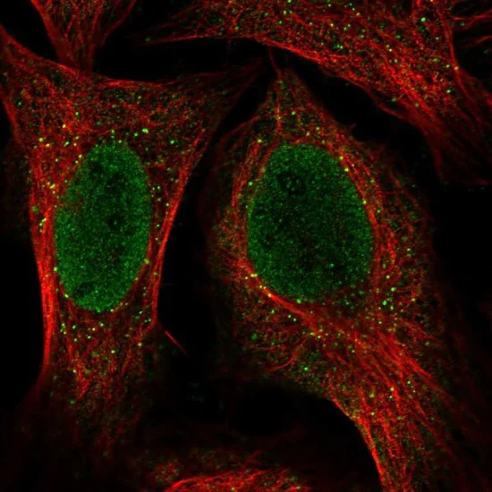 Immunocytochemistry/ Immunofluorescence - Anti-K34 antibody - C-terminal (AB222074)