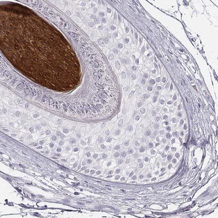 Immunohistochemistry (Formalin/PFA-fixed paraffin-embedded sections) - Anti-K34 antibody - C-terminal (AB222074)
