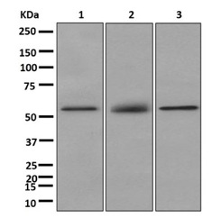 Western blot - Anti-K73 antibody [EPR12564-39] (AB181383), expandable thumbnail