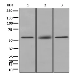 Western blot - Anti-K73 antibody [EPR12564-39] (AB181383)