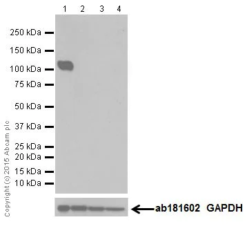 Western blot - Anti-KA1 antibody [EPR18322] - BSA and Azide free (AB251434)