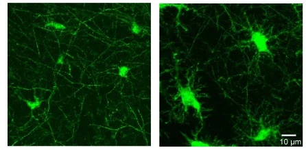 Immunocytochemistry/ Immunofluorescence - Kainic acid (mM/ml), Prototypic kainate receptor agonist (AB144490)