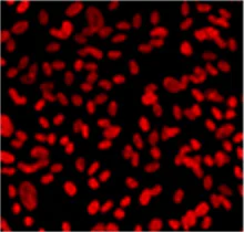 Immunocytochemistry/ Immunofluorescence - Anti-Kaiso antibody [6F / 6F8] (AB12723)