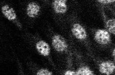 Immunocytochemistry/ Immunofluorescence - Anti-Kaiso antibody [6F / 6F8] (AB12723)