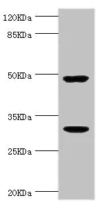 Western blot - Anti-Kallikrein 10/K10 antibody (AB229968)