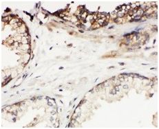 Immunohistochemistry (Formalin/PFA-fixed paraffin-embedded sections) - Anti-Kallikrein 11 antibody (AB131038), expandable thumbnail
