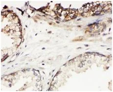 Immunohistochemistry (Formalin/PFA-fixed paraffin-embedded sections) - Anti-Kallikrein 11 antibody (AB131038)