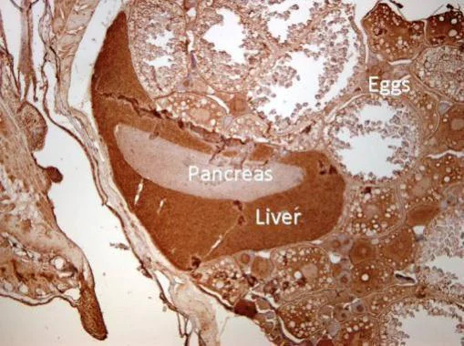 Immunohistochemistry (Formalin/PFA-fixed paraffin-embedded sections) - Anti-Kallikrein 11 antibody (AB131038)