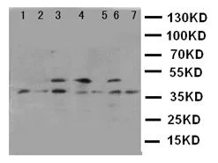 Western blot - Anti-Kallikrein 11 antibody (AB131038)