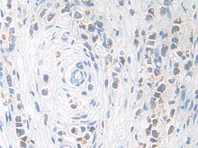 Immunohistochemistry (Formalin/PFA-fixed paraffin-embedded sections) - Anti-Kallikrein 11 antibody (AB233278)