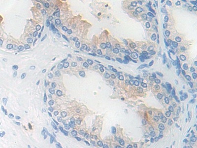 Immunohistochemistry (Formalin/PFA-fixed paraffin-embedded sections) - Anti-Kallikrein 11 antibody (AB233278)