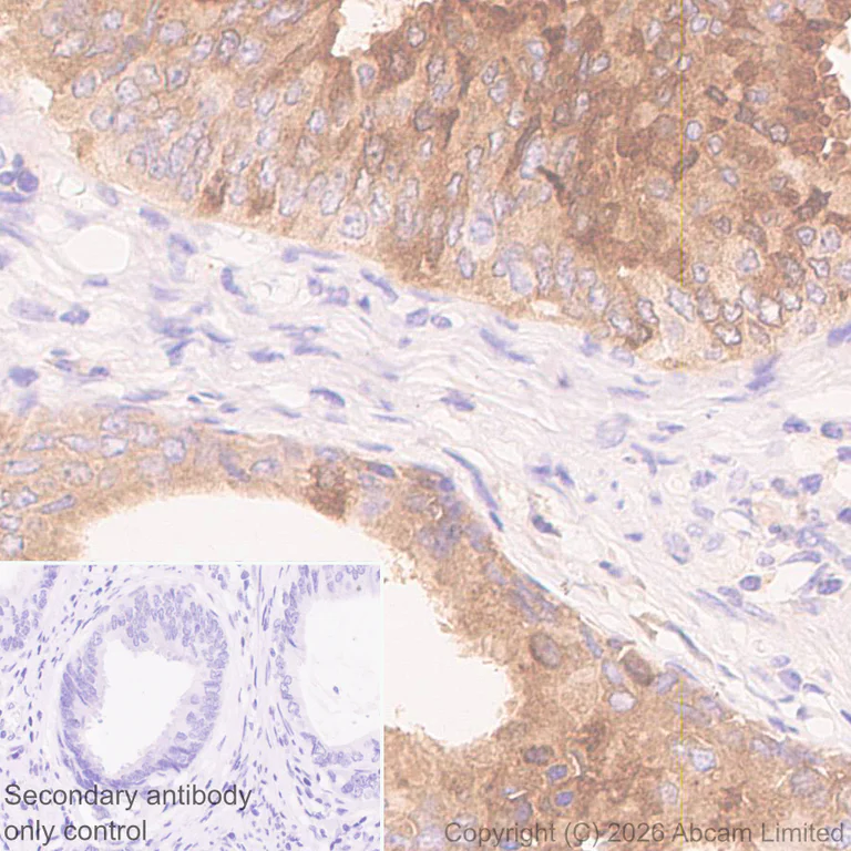 Immunohistochemistry (Formalin/PFA-fixed paraffin-embedded sections) - Anti-Kallikrein-11 antibody [EPR31011-525R] (AB326566)