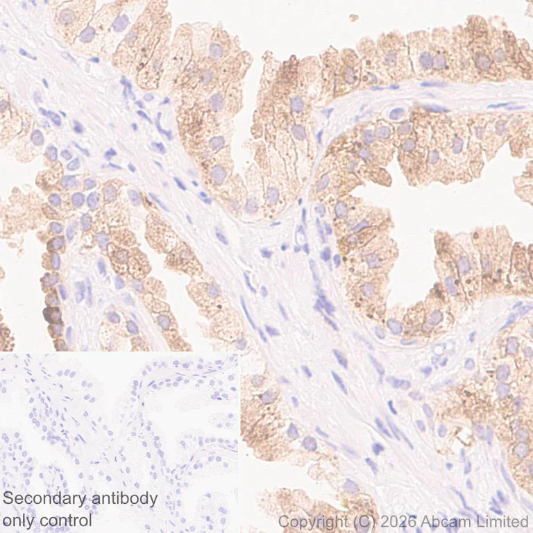 Immunohistochemistry (Formalin/PFA-fixed paraffin-embedded sections) - Anti-Kallikrein-11 antibody [EPR31011-525R] (AB326566)