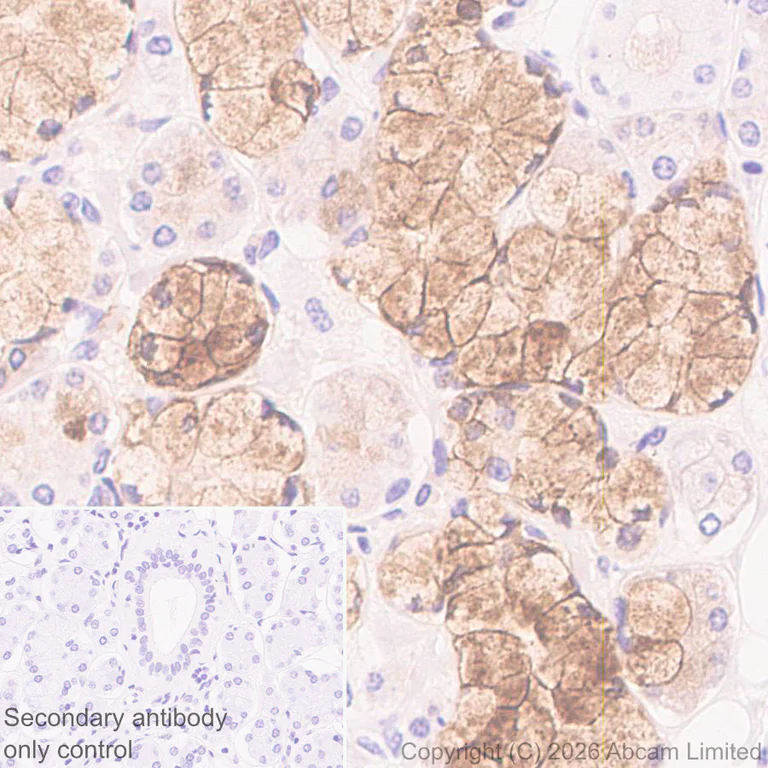 Immunohistochemistry (Formalin/PFA-fixed paraffin-embedded sections) - Anti-Kallikrein-11 antibody [EPR31011-525R] (AB326566)
