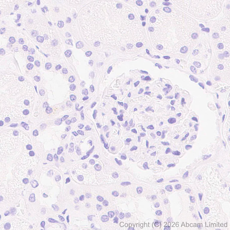 Immunohistochemistry (Formalin/PFA-fixed paraffin-embedded sections) - Anti-Kallikrein-11 antibody [EPR31011-525R] (AB326566)