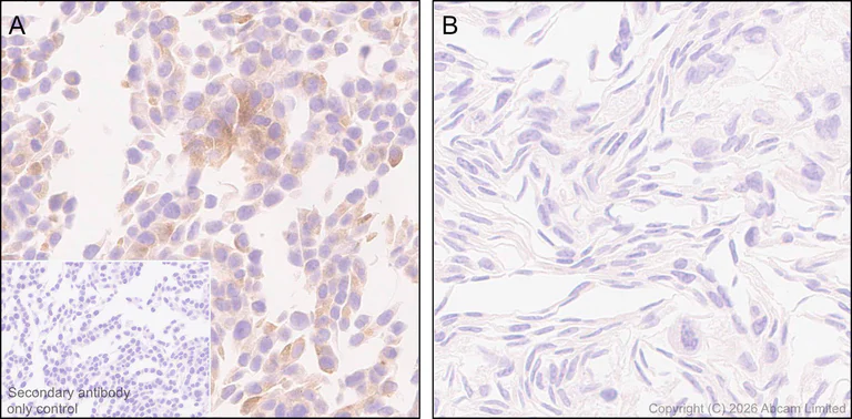 Immunohistochemistry (Formalin/PFA-fixed paraffin-embedded sections) - Anti-Kallikrein-11 antibody [EPR31011-525R] (AB326566)