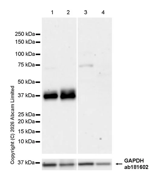 Western blot - Anti-Kallikrein-11 antibody [EPR31011-525R] (AB326566)