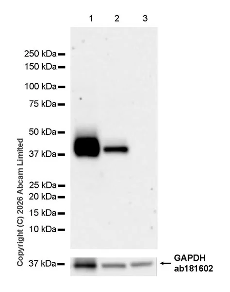 Western blot - Anti-Kallikrein-11 antibody [EPR31011-525R] (AB326566)