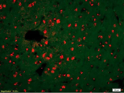 Immunohistochemistry (Formalin/PFA-fixed paraffin-embedded sections) - Anti-Kallikrein 14 antibody (AB203226)