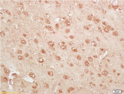 Immunohistochemistry (Formalin/PFA-fixed paraffin-embedded sections) - Anti-Kallikrein 14 antibody (AB203226)