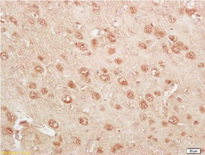 Immunohistochemistry (Formalin/PFA-fixed paraffin-embedded sections) - Anti-Kallikrein 14 antibody (AB203226)