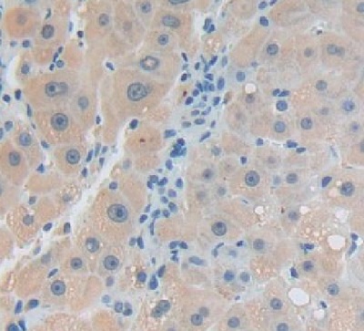 Immunohistochemistry (Formalin/PFA-fixed paraffin-embedded sections) - Anti-Kallikrein 14 antibody (AB232966), expandable thumbnail