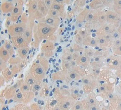Immunohistochemistry (Formalin/PFA-fixed paraffin-embedded sections) - Anti-Kallikrein 14 antibody (AB232966)